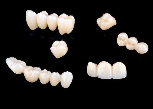 Double layer Zirconia crown
